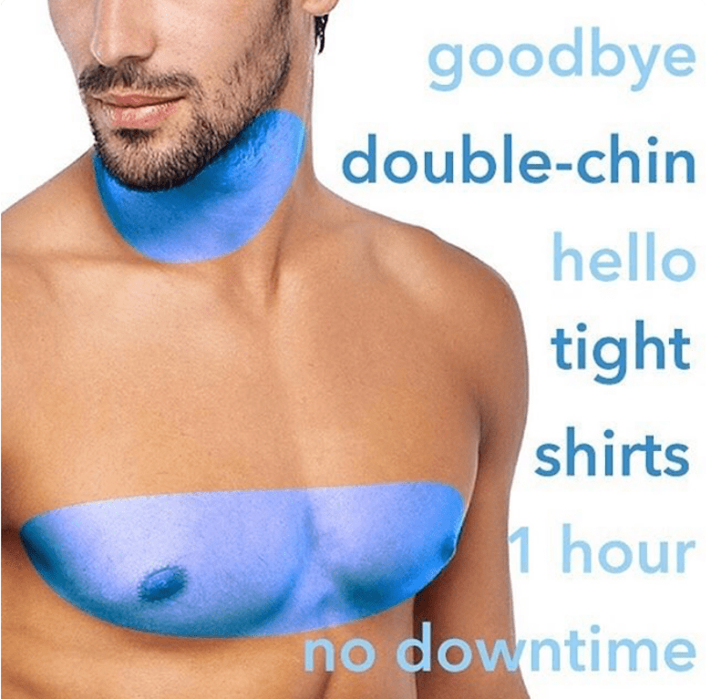 coolsculpting mens chest