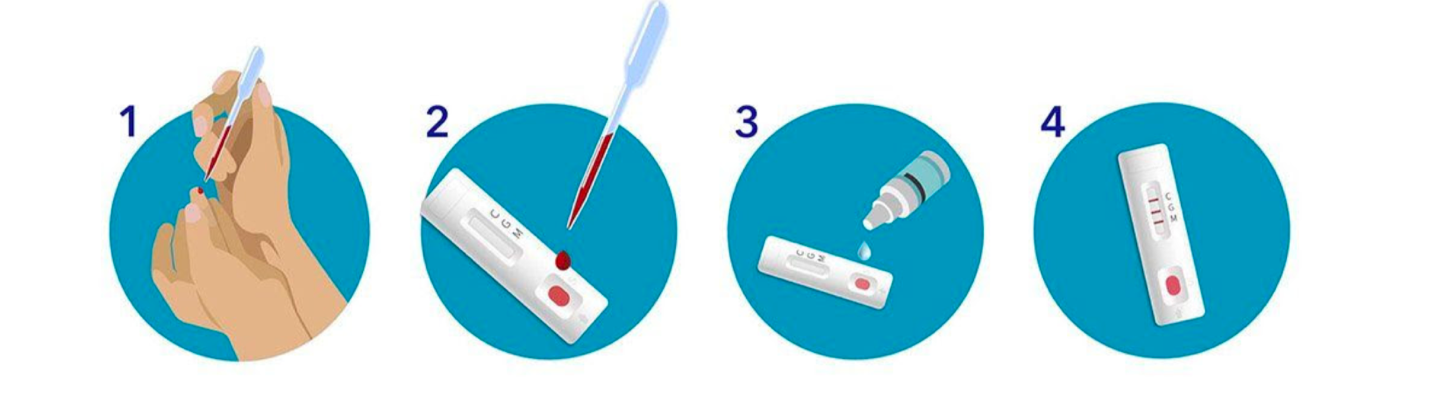 Covid 19 Anti-Body Testing Diagram