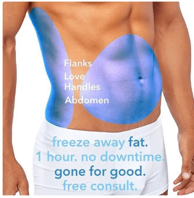 Showcases a male torso with specific areas—flanks, love handles, and abdomen—highlighted in blue to indicate target zones for fat freezing Man's torso with blue highlighted areas for fat reduction on flanks