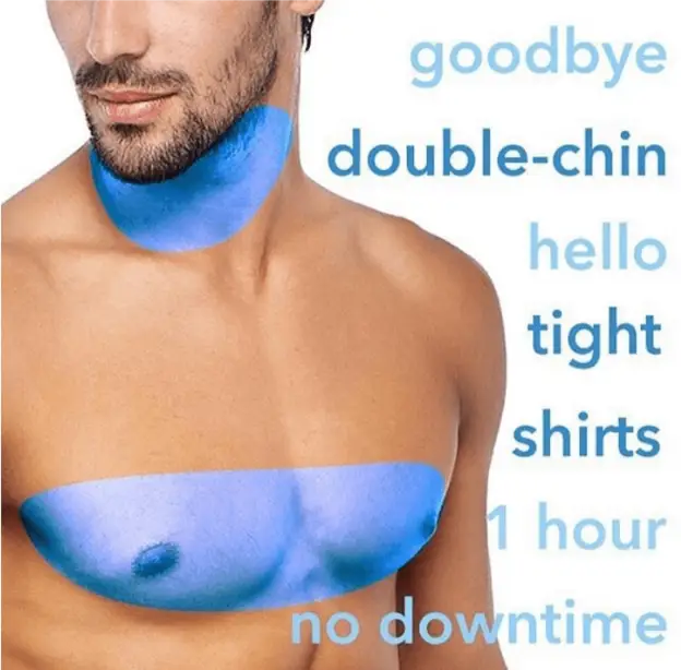 Coolsculpting male freeze fat
